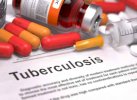 AS Hentikan Bantuan Obat HIV-TBC ke Sejumlah Negara, Indonesia Terdampak