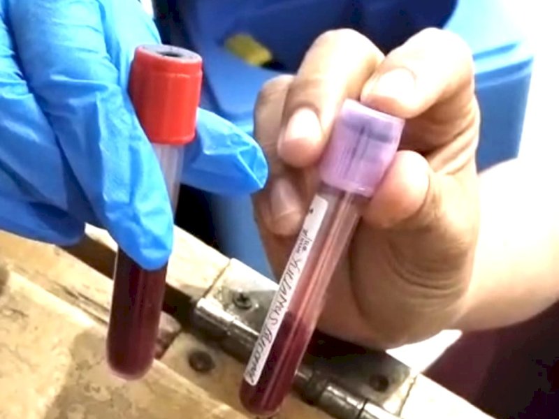 Hasil rekomendasi golongan darah pasien yang berbeda antara RSUD Pongtiku dengan RSUD Lakipadada. 