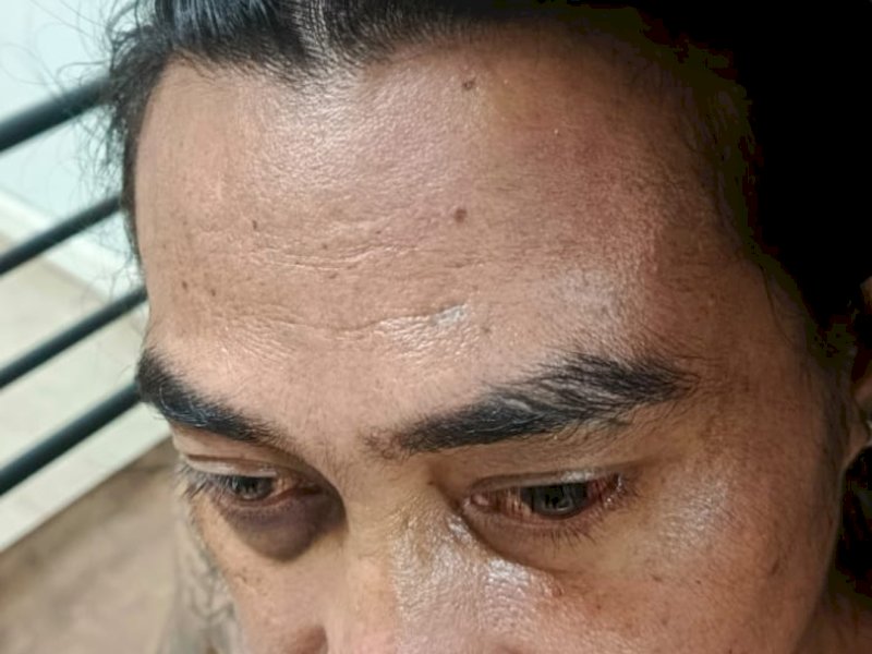 Yan, korban pengeroyokan di arena sabung ayam di Bahodopi, Morowali. 