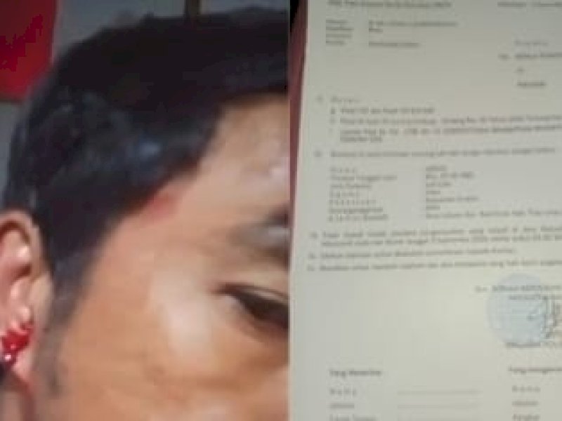 Senggolan di Bus, Karyawan PT FBM Morowali Babak Belur Dikeroyok Rekan Kerja 