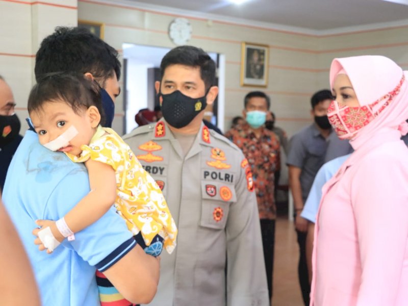 Kapolda Sulsel saat memantau operasi bibir sumbing. 
