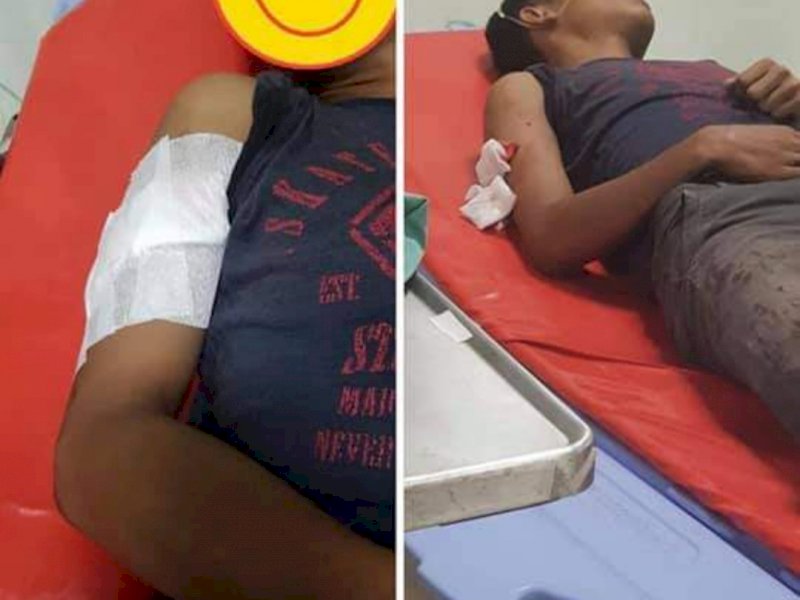 Korban penusukan oleh pria misterius di Bulukumba. 