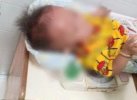 Salah Sasaran, Bayi 1 Tahun di Makassar Tertembus Anak Panah di Pipi