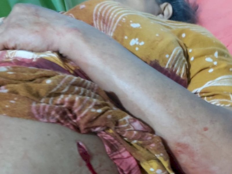 Korban penikaman sementara dirawat di puskesmas Bulukumba. 