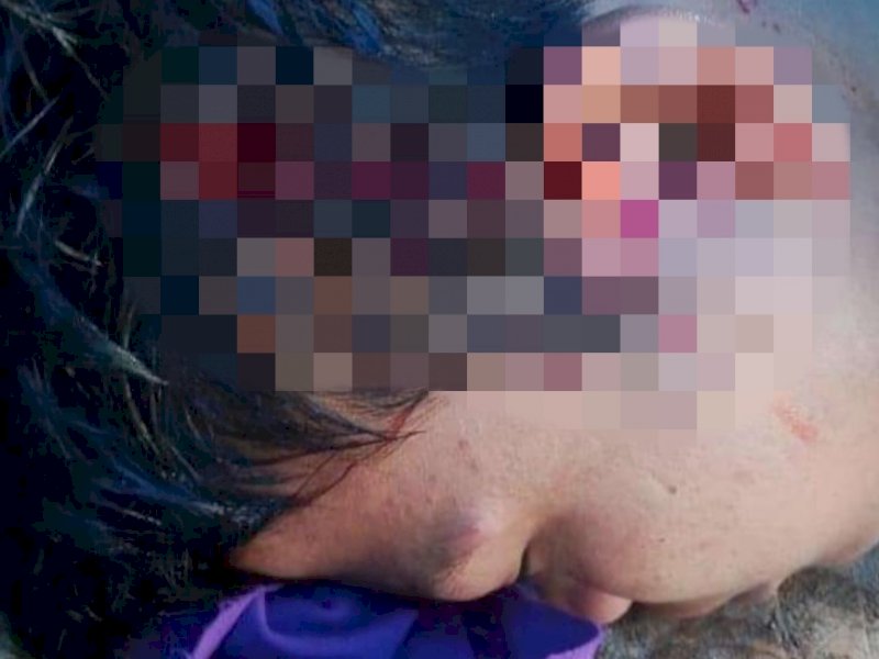 Luka diduga bekas oknum polisi di Tator. 