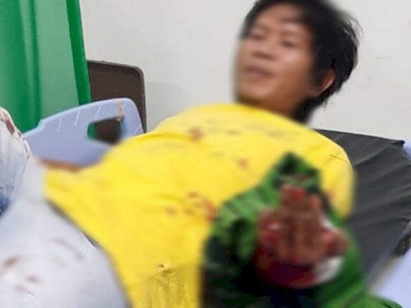 Sala seorang warga yang ditebas di Bulukumba saat dilarikan ke rumah sakit. 