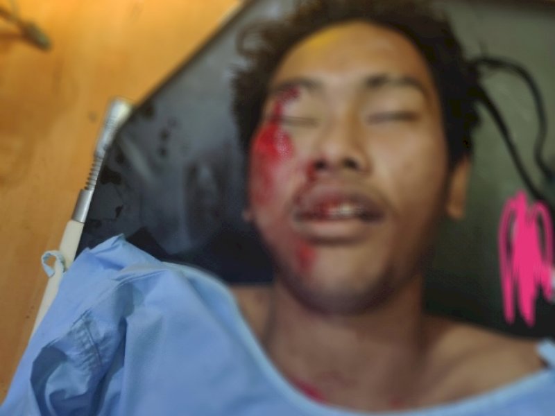 Korban lakalantas tanpa identitas meninggal di RSUD Haji Makassar.